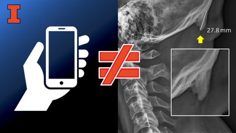 Thumbnail for Is cellphone use causing people to grow horns?  Illinois prof says &quot;Nope&quot;